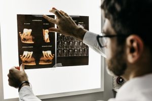 caring for your dental implants