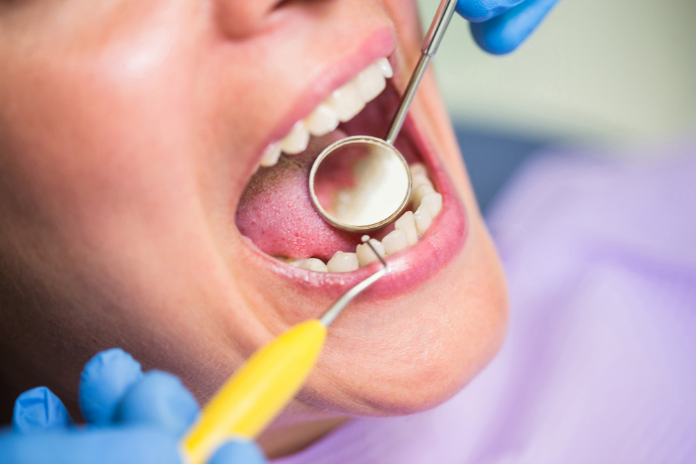 periodontal disease