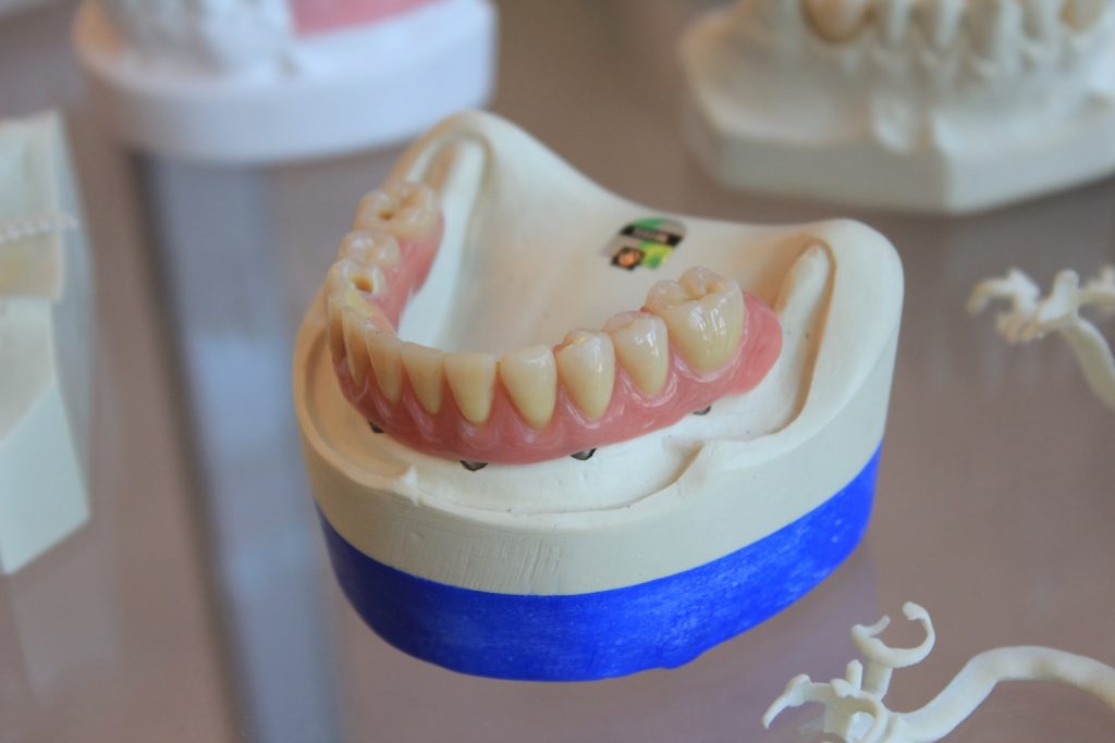 snap in dentures