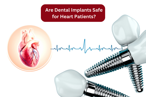 Are Dental Implants Safe for Heart Patients