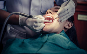 Dental Filling