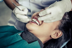 Teeth Extraction