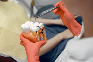 tooth