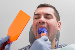 Clenching Teeth