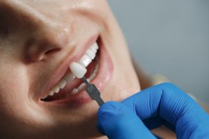 Dental Implant vs Crown